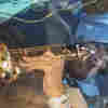 This Music Teacher Played His Saxophone While In Brain Surgery