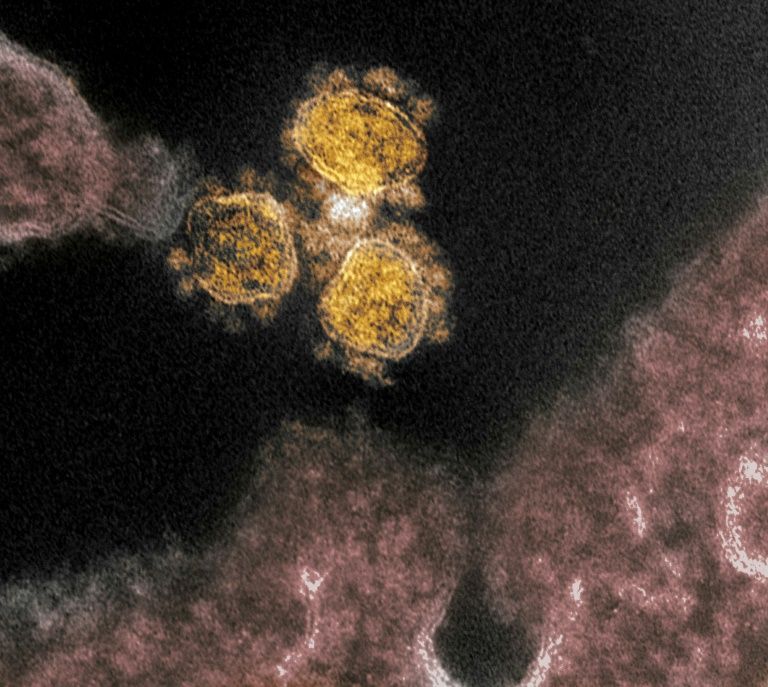 The fast-spreading COVID-19 coronavirus is believed to be more dangerous for older adults, though increasingly it appears to be also sending younger patients to hospital as well
