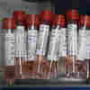 Pooling Coronavirus Tests Can Spare Scarce Supplies, But There's A Catch