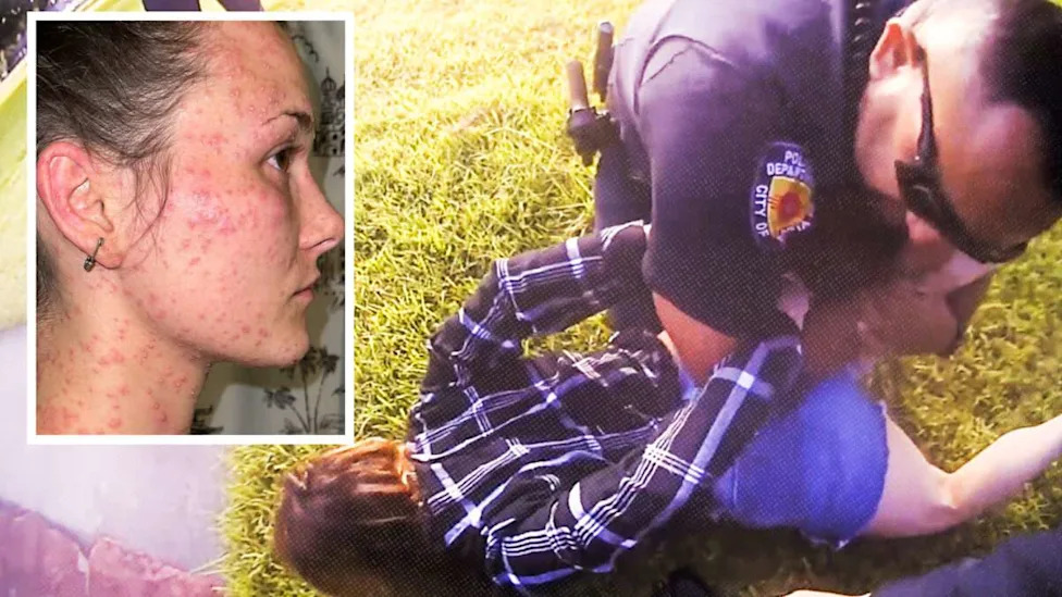 fire ant bites on Taylor Rogers next to a picture of Rogers handcuffed and held on the ground by law enforcement
